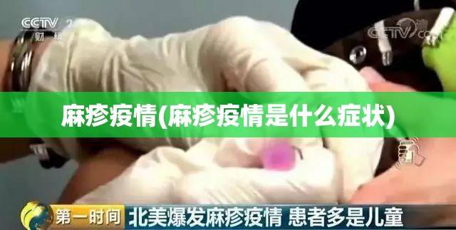 麻疹疫情(麻疹疫情是什么症状)