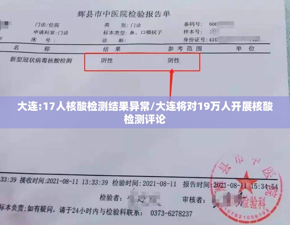 大连:17人核酸检测结果异常/大连将对19万人开展核酸检测评论