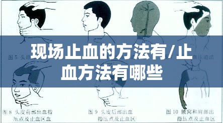 现场止血的方法有/止血方法有哪些